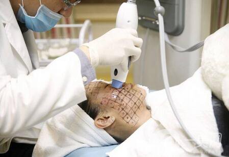 熱瑪吉緊膚除皺價(jià)格多少錢？