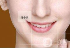 法令紋深怎么改良呢?去除法令紋的方式有哪些?