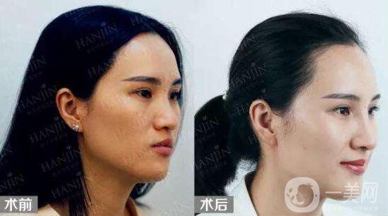 *,注意事項(xiàng)