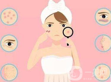 怎么去痘印啊 激光祛痘印*果介紹