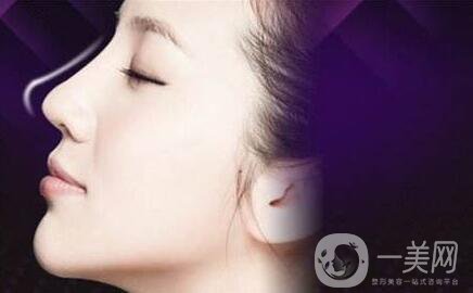 成都肋軟骨隆鼻價格需要多少錢