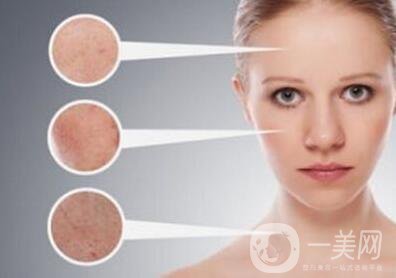 黃褐斑的形成原因是什么？