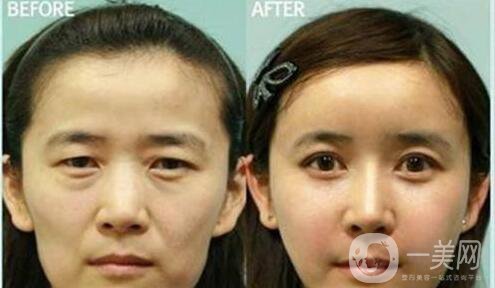 廣州,熱瑪吉緊膚,多少錢