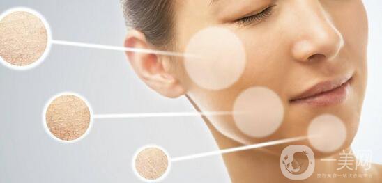 花斑癬調節(jié)方法有哪些？