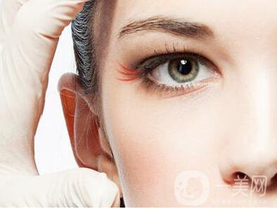 深圳魚尾紋打玻尿酸,深圳魚尾紋打玻尿酸要多少錢