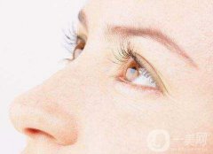 埋線雙眼皮5天能消腫嗎？