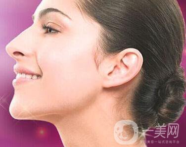 雙下巴吸脂多少錢？價格盤點！