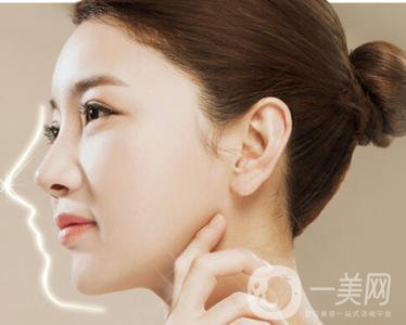 硅膠墊鼻梁整形手術(shù)*果保持*嗎