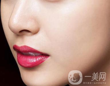 鼻小柱延長整形手術(shù)之后多久恢復正常