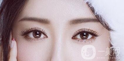 全切雙眼皮多久恢復？