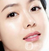 開內(nèi)眼角多久恢復自然？