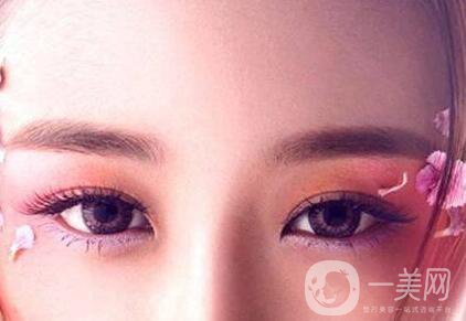 開(kāi)內(nèi)眼角多久恢復(fù)自然？