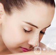 鼻部手術(shù)整形手術(shù)之后多久才能笑自然