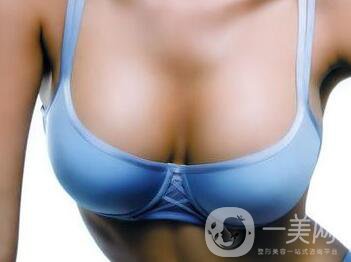 硅膠隆胸能管多久？隆胸手術(shù)具體費(fèi)用
