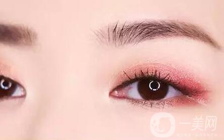 雙眼皮全切拆線后護理怎么做