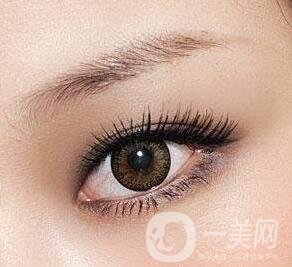 雙眼皮全切拆線后護理怎么做