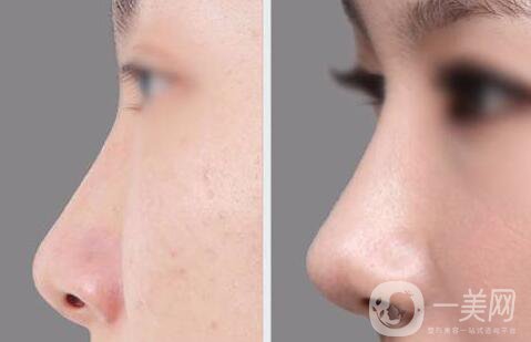 *后吃什么消腫快