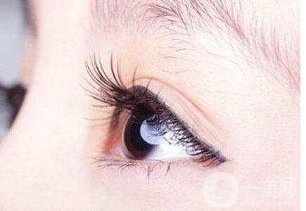 割雙眼皮,開眼角,眼部整形,眼部整形術(shù)后護(hù)理