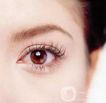 全切雙眼皮手術(shù)疼嗎