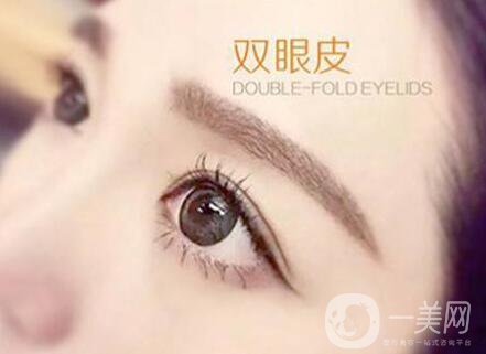 割雙眼皮痕跡多久消失？