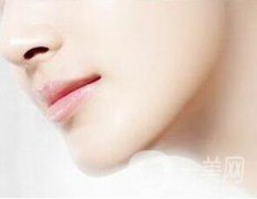 吸脂去雙下巴果怎么樣?術(shù)后如何護(hù)理?