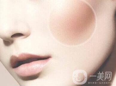 顴骨手術(shù)多長(zhǎng)時(shí)間恢復(fù)？