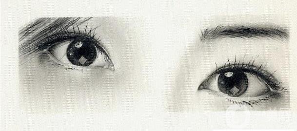 割雙眼皮術(shù),雙眼皮術(shù)后注意事項