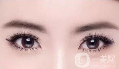 割雙眼皮變太窄的原因是什么？