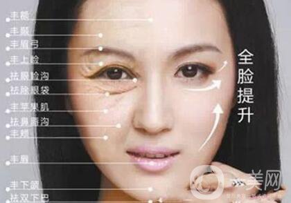 電波拉皮多長時間做一次？