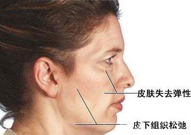 電波拉皮*果嗎？