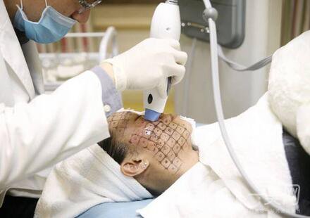 北京整形熱瑪吉拉皮價格要多少錢？