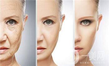 北京整形熱瑪吉拉皮價格要多少錢？