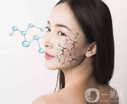 冰電波拉皮價格是多少？