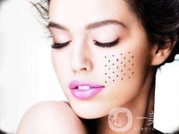 冰電波拉皮價格是多少？