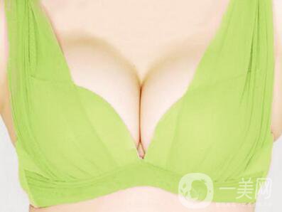 假體豐胸手術(shù)大概多少錢(qián)