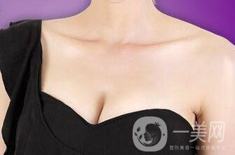 假體豐胸恢復(fù)期多久？