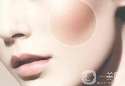 顴骨肉怎么消？怎么縮小顴骨？