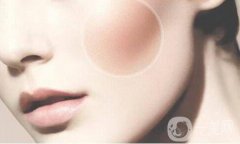 磨顴骨恢復(fù)期要多久 術(shù)后護(hù)理方式