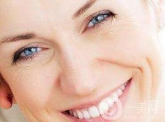 自體脂肪去法令紋怎么樣？