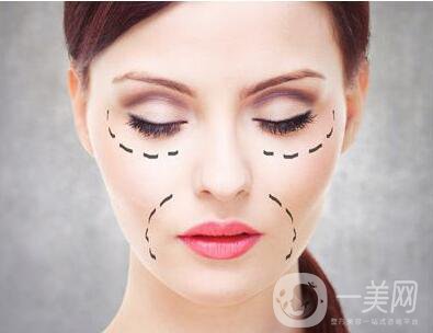 玻尿酸去除法令紋,玻尿酸去除法令紋價(jià)格,玻尿酸去除法令紋注意事項(xiàng)