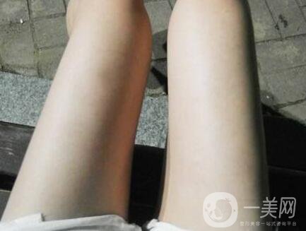 大腿抽脂怎樣快速消腫？術(shù)后護(hù)理方法解說(shuō)