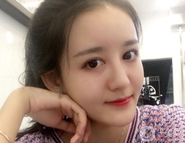 玻尿酸面部填充,玻尿酸面部填充術后護理