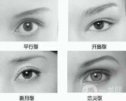 做韓式*雙眼皮術(shù)的優(yōu)點(diǎn)有哪些？