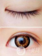 開完眼角怎么預防增生？