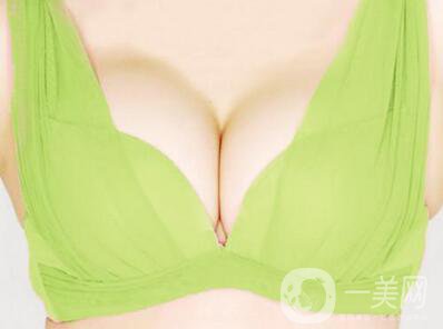 假體隆胸手術(shù)*嗎