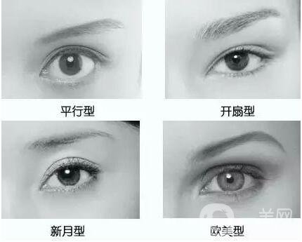 割雙眼皮,割雙眼皮維持多久,割雙眼皮多久恢復(fù)