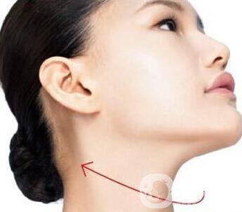 雙下巴吸脂術(shù)后護(hù)理方法