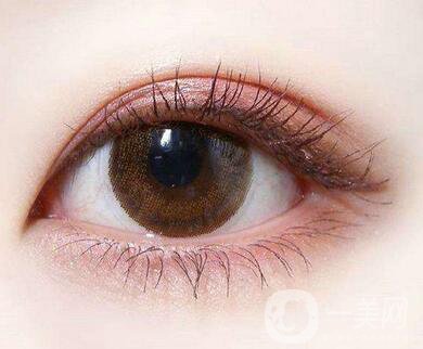 怎樣判斷雙眼皮增生了呢？