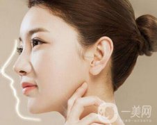 肋骨隆鼻多久可以修復(fù)？