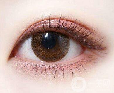 雙眼皮手術后期護理怎么做？